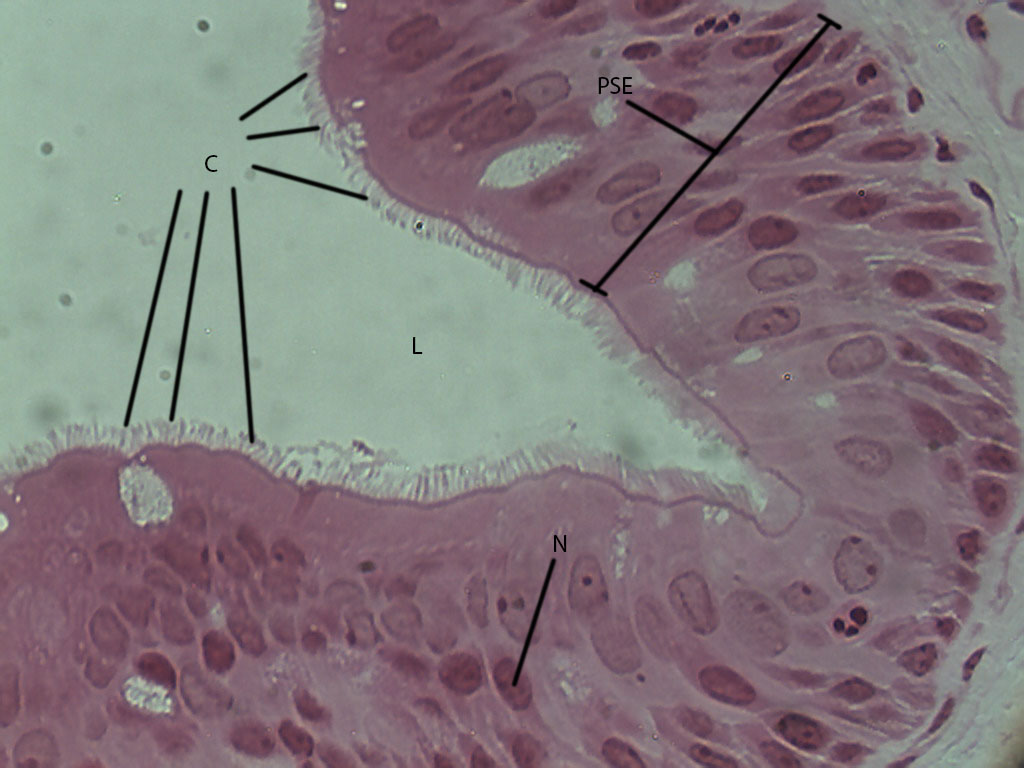 Columnar Epithelium Labeled
